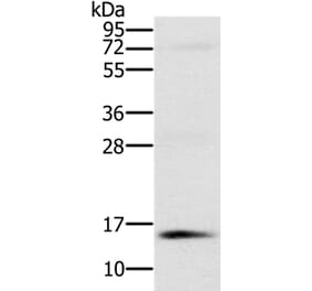 NDUFA6 Antibody from Signalway Antibody (36639) - Antibodies.com