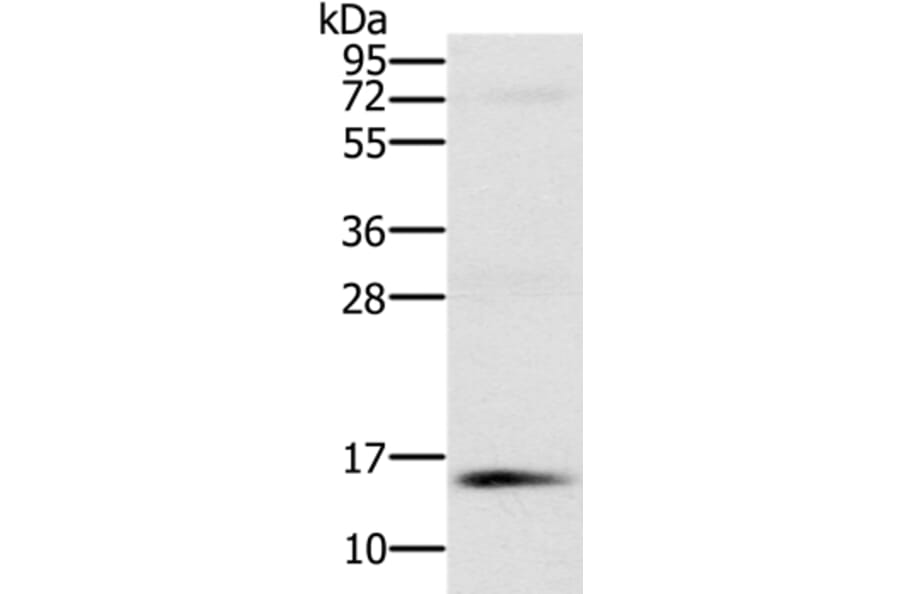 NDUFA6 Antibody from Signalway Antibody (36639) - Antibodies.com