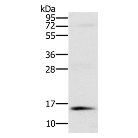 NDUFA6 Antibody from Signalway Antibody (36639) - Antibodies.com