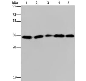 OCIAD1 Antibody from Signalway Antibody (36666) - Antibodies.com