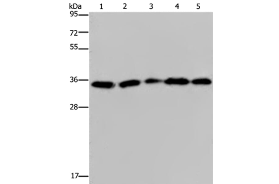 OCIAD1 Antibody from Signalway Antibody (36666) - Antibodies.com