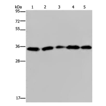 OCIAD1 Antibody from Signalway Antibody (36666) - Antibodies.com