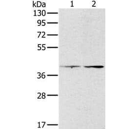 PDGFRL Antibody from Signalway Antibody (36686) - Antibodies.com