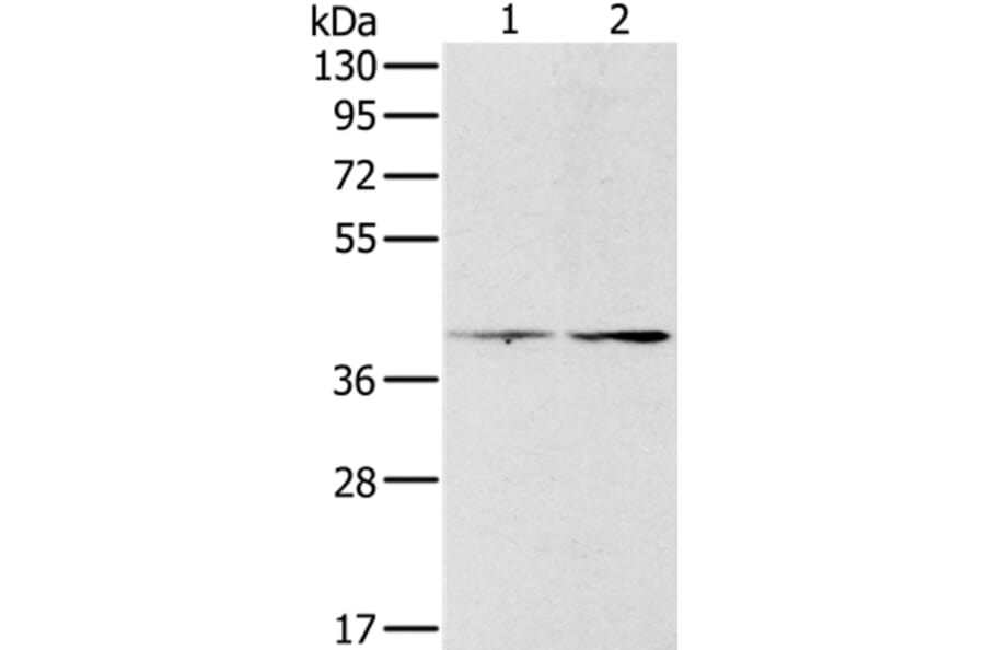 PDGFRL Antibody from Signalway Antibody (36686) - Antibodies.com