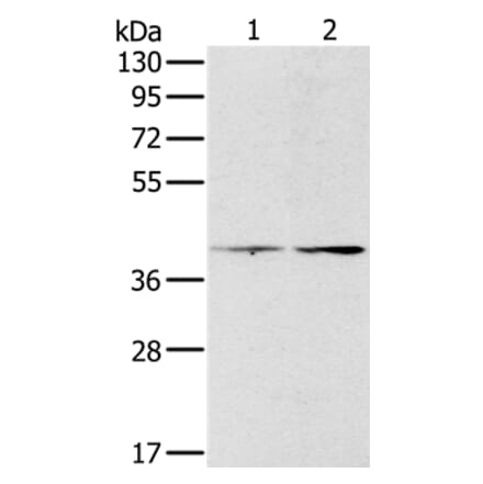 PDGFRL Antibody from Signalway Antibody (36686) - Antibodies.com