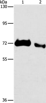 Gel: 6%SDS-PAGE Lysates (from left to right): Human fetal brain and human lymphoma tissue Amount of lysate: 80ug per lane Primary antibody: 1/100 dilution Secondary antibody dilution: 1/8000 Exposure time: 10 minutes