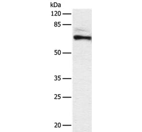 DPYSL2 Antibody from Signalway Antibody (36804) - Antibodies.com