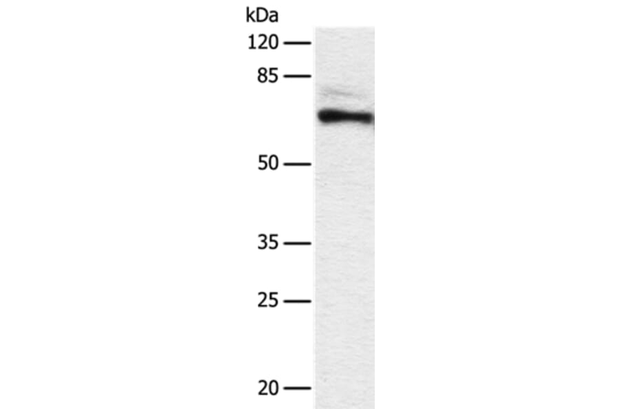 DPYSL2 Antibody from Signalway Antibody (36804) - Antibodies.com