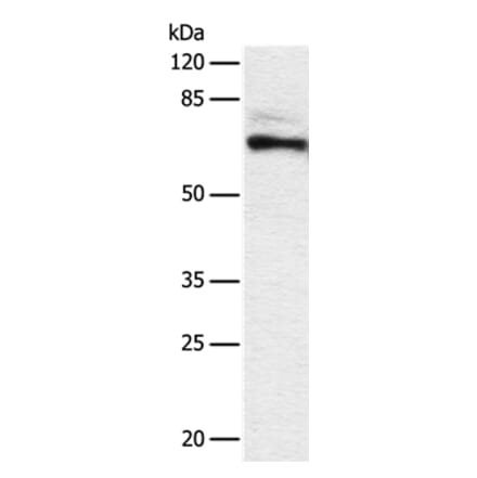 DPYSL2 Antibody from Signalway Antibody (36804) - Antibodies.com
