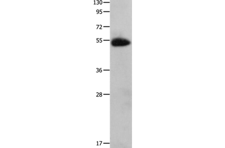 CX3CR1 Antibody from Signalway Antibody (36817) - Antibodies.com