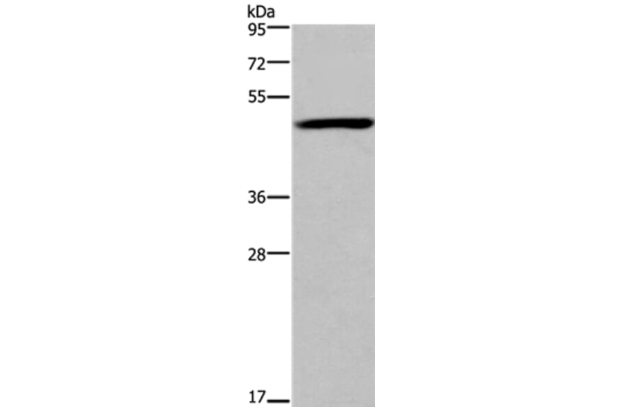 FOXD1 Antibody from Signalway Antibody (36863) - Antibodies.com