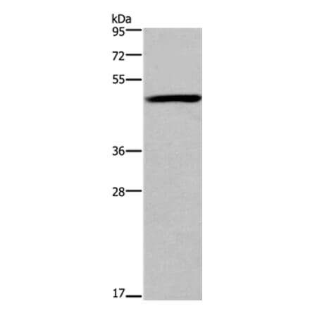 FOXD1 Antibody from Signalway Antibody (36863) - Antibodies.com