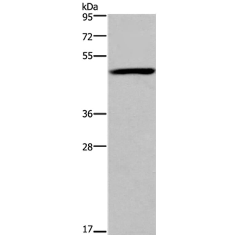 FOXD1 Antibody from Signalway Antibody (36863) - Antibodies.com