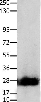 Gel: 10% SDS-PAGE Lysates (from left to right): Mouse pancreas tissue Amount of lysate: 30ug per lane Primary antibody: 1/200 dilution Secondary antibody dilution: 1/8000 Exposure time: 50 seconds