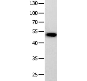 PROKR2 Antibody from Signalway Antibody (36910) - Antibodies.com