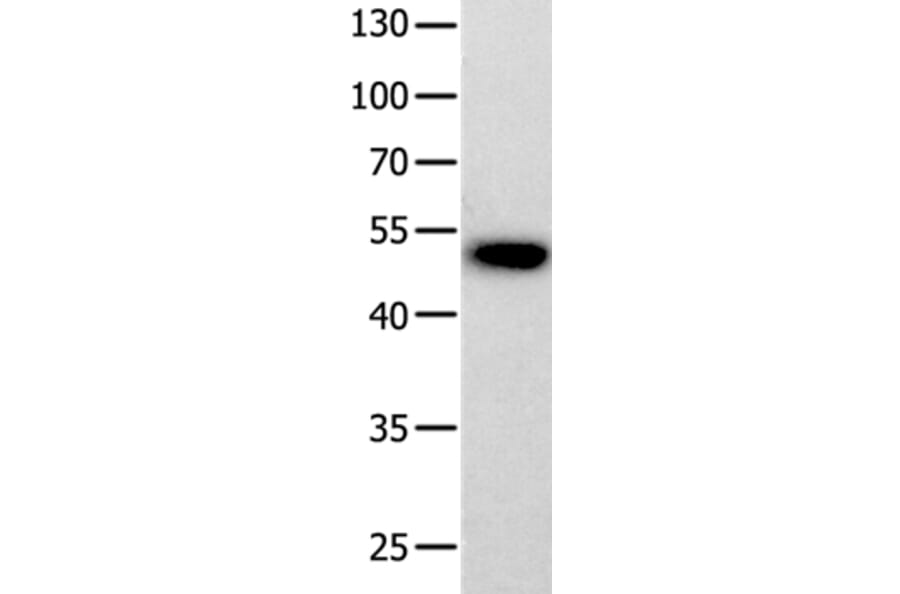 PROKR2 Antibody from Signalway Antibody (36910) - Antibodies.com