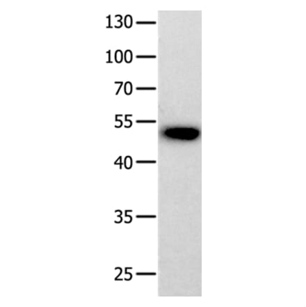 PROKR2 Antibody from Signalway Antibody (36910) - Antibodies.com