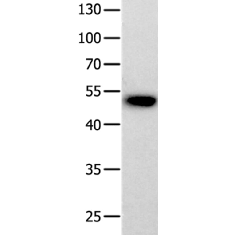 PROKR2 Antibody from Signalway Antibody (36910) - Antibodies.com