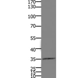 HOXD11 Antibody from Signalway Antibody (36925) - Antibodies.com