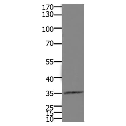 HOXD11 Antibody from Signalway Antibody (36925) - Antibodies.com