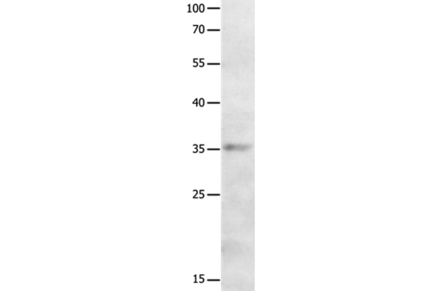 MAGEA2 Antibody from Signalway Antibody (36965) - Antibodies.com