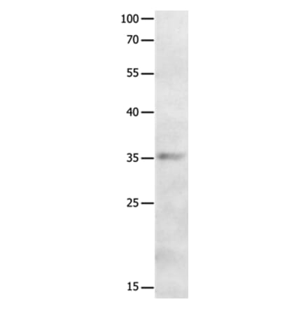 MAGEA2 Antibody from Signalway Antibody (36965) - Antibodies.com