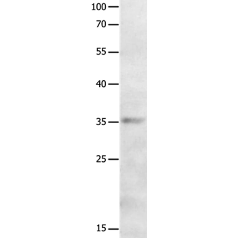 MAGEA2 Antibody from Signalway Antibody (36965) - Antibodies.com