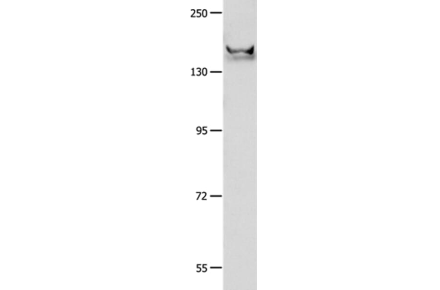 GRIN2B Antibody from Signalway Antibody (37002) - Antibodies.com