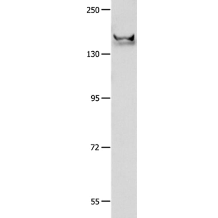 GRIN2B Antibody from Signalway Antibody (37002) - Antibodies.com