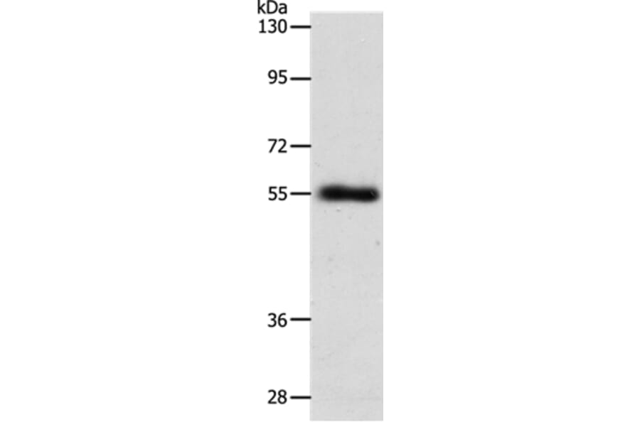 SLC1A5 Antibody from Signalway Antibody (37032) - Antibodies.com
