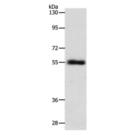 SLC1A5 Antibody from Signalway Antibody (37032) - Antibodies.com