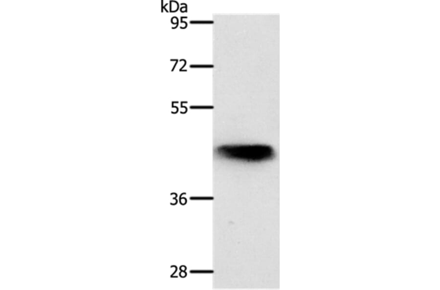NKX2-1 Antibody from Signalway Antibody (37057) - Antibodies.com
