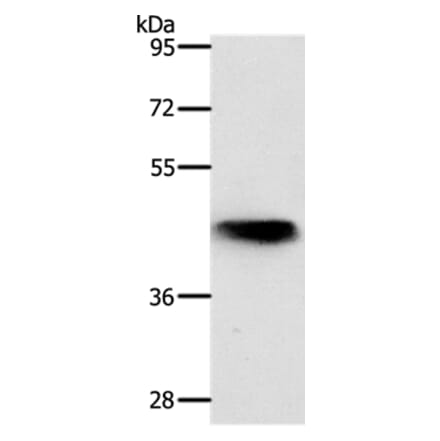 NKX2-1 Antibody from Signalway Antibody (37057) - Antibodies.com