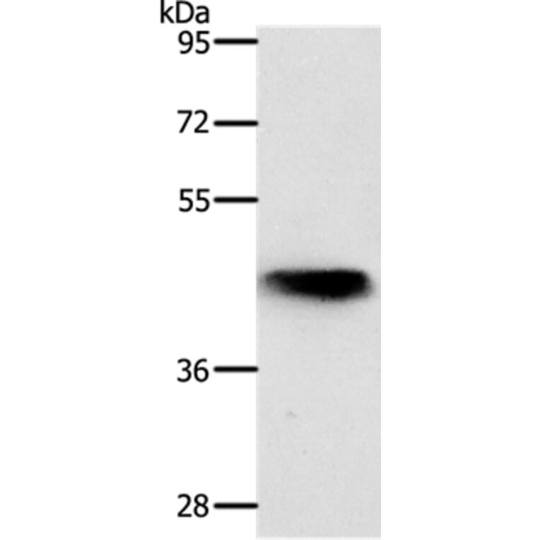 NKX2-1 Antibody from Signalway Antibody (37057) - Antibodies.com