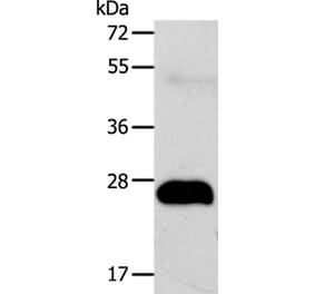 AGPAT2 Antibody from Signalway Antibody (37090) - Antibodies.com