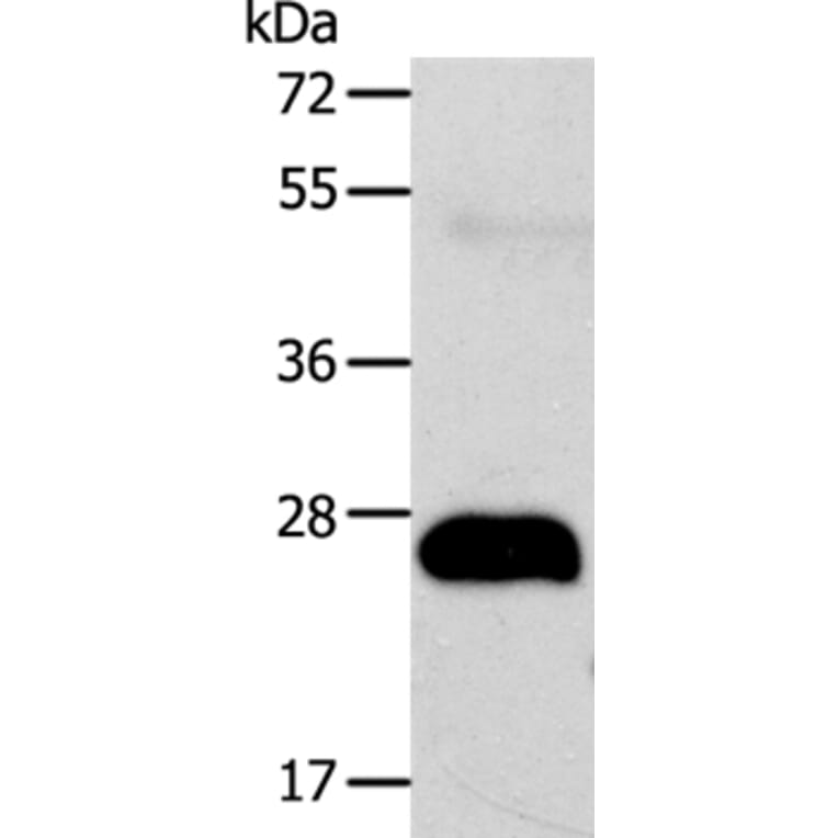 AGPAT2 Antibody from Signalway Antibody (37090) - Antibodies.com