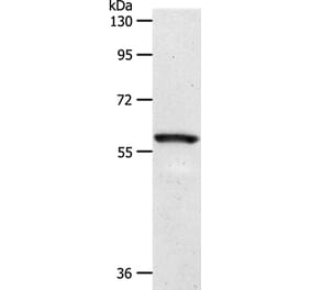 SLC5A1 Antibody from Signalway Antibody (37240) - Antibodies.com