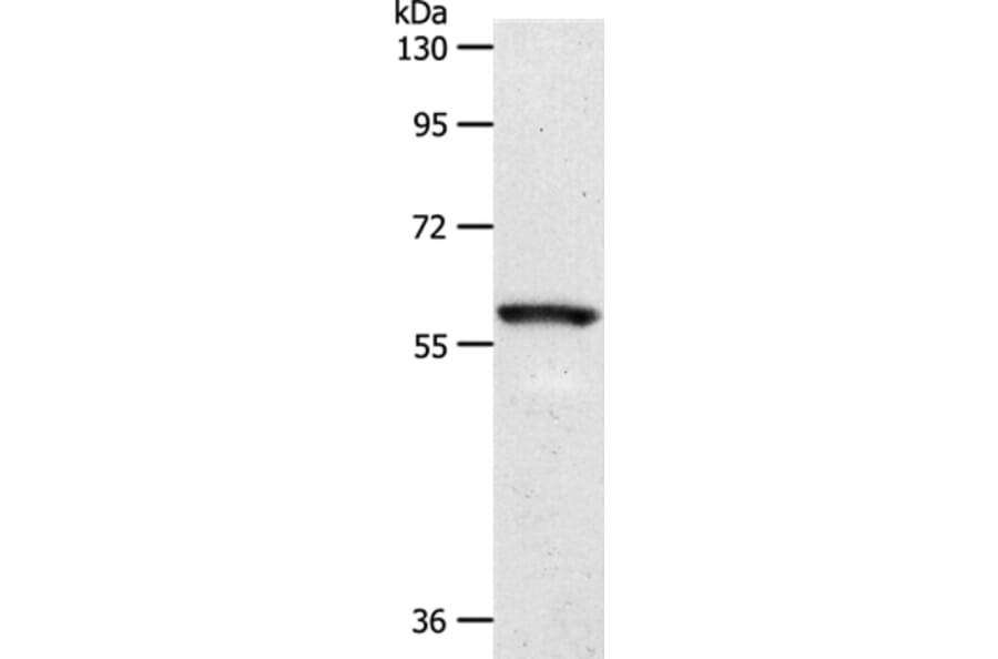 SLC5A1 Antibody from Signalway Antibody (37240) - Antibodies.com