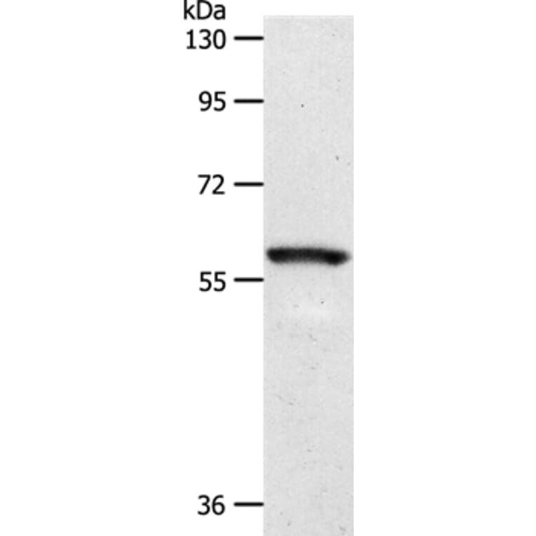 SLC5A1 Antibody from Signalway Antibody (37240) - Antibodies.com