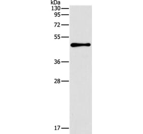 TFAP2B Antibody from Signalway Antibody (37333) - Antibodies.com