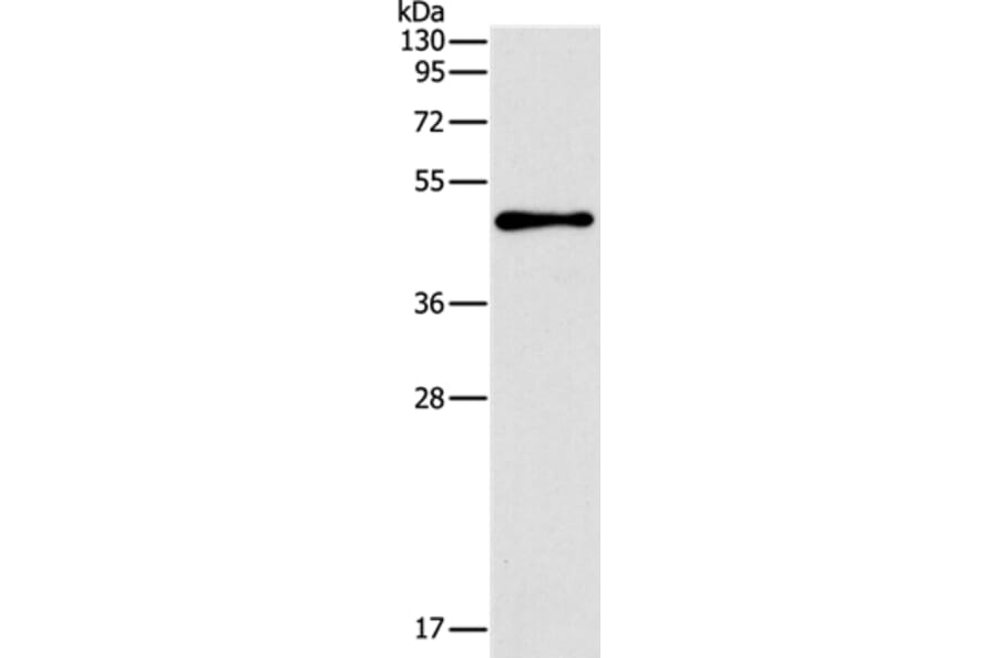 TFAP2B Antibody from Signalway Antibody (37333) - Antibodies.com