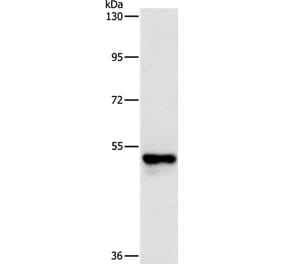 PFKFB2 Antibody from Signalway Antibody (37382) - Antibodies.com