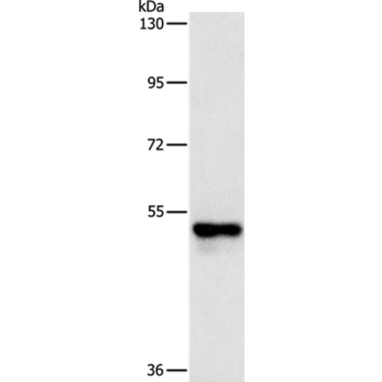 PFKFB2 Antibody from Signalway Antibody (37382) - Antibodies.com