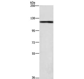 TSPYL2 Antibody from Signalway Antibody (37489) - Antibodies.com