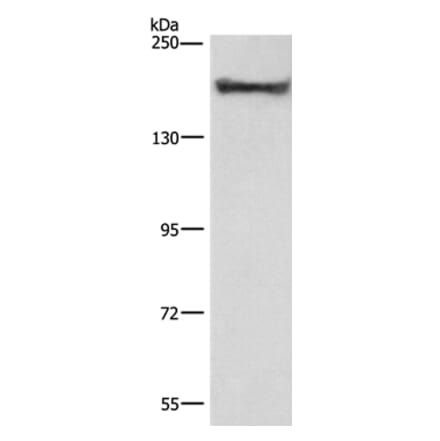 COL4A2 Antibody from Signalway Antibody (37494) - Antibodies.com