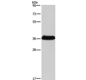 IFNGR2 Antibody from Signalway Antibody (37643) - Antibodies.com