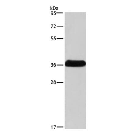 IFNGR2 Antibody from Signalway Antibody (37643) - Antibodies.com