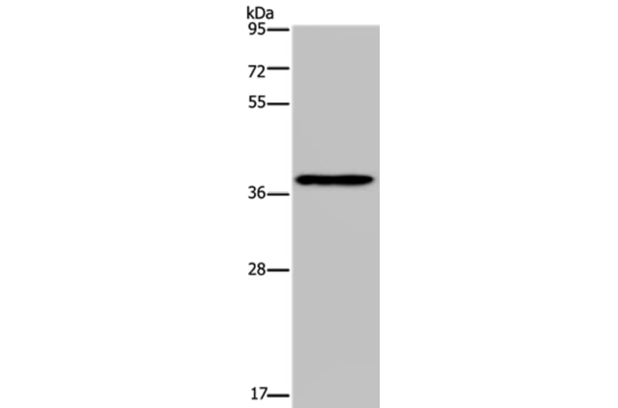 PCBP4 Antibody from Signalway Antibody (37719) - Antibodies.com