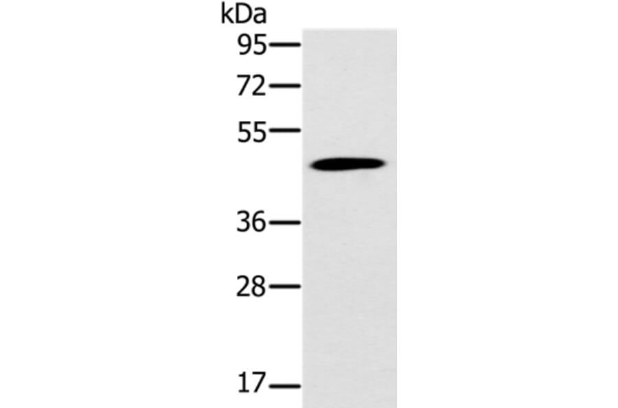 KCNJ15 Antibody from Signalway Antibody (37871) - Antibodies.com