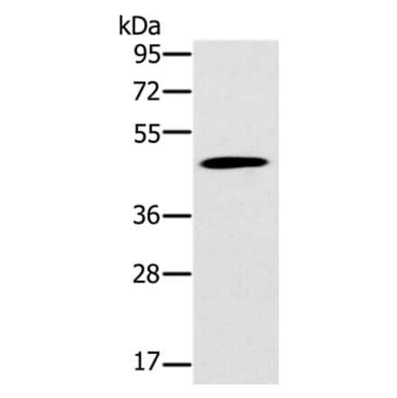 KCNJ15 Antibody from Signalway Antibody (37871) - Antibodies.com